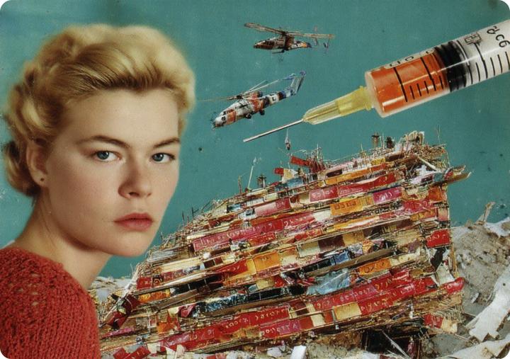 Ожоги, шрамы и отеки: 4 самые болезненные процедуры для омоложения кожи. Стоит ли страдать